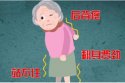 绿巨人视频app黄色官方下载治疗仪老年人骨质疏松的治疗方法,如何预防骨质疏松症
