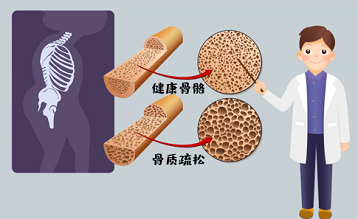 超声便捷式绿巨人视频app黄色官方下载仪品牌如同人容貌衰老一样身体骨骼不保养一样衰老