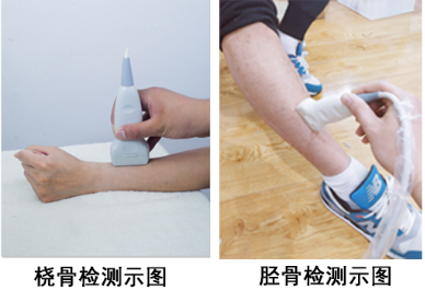 便捷式绿巨人视频app黄色官方下载检测仪测量部位测量准确重复性好保证测量结果的一致性