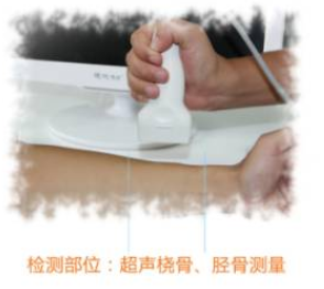超声波绿巨人视频app黄色官方下载仪生产厂家用于测定人体骨矿并获得骨骼相关数据