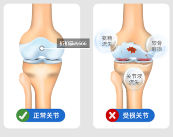 绿巨人视频污版app最新版超声绿巨人视频app黄色官方下载仪厂家不管是青年还是老人都需要的绿巨人视频app黄色官方下载