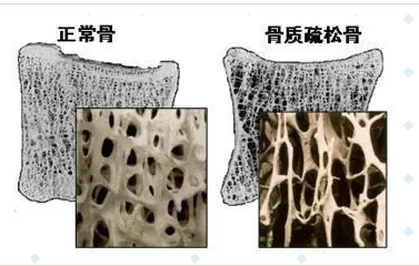 随着年龄的增长，你变矮了吗?超声波绿巨人视频app黄色官方下载仪的厂家已经揭示了他们的秘密