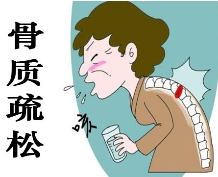 绿巨人视频app黄色官方下载仪为什么在核医学科,绿巨人视频app黄色官方下载仪在骨质疏松的应用 绿巨人视频app黄色官方下载仪为什么在核医学科,绿巨人视频app黄色官方下载仪在骨质疏松的应用