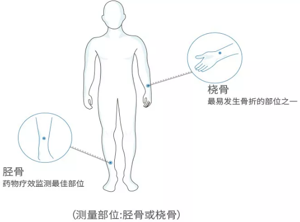超声波绿巨人视频app黄色官方下载分析仪厂家 国产老年人超声波绿巨人视频app黄色官方下载分析仪厂家